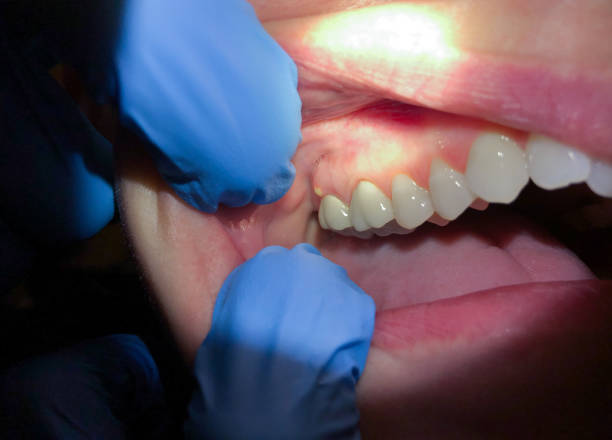 Best Emergency Dentist for Special Needs Patients in Keego Harbor, MI